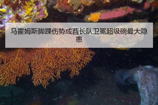 ma-huo-mu-si-jiao-huai-shang-shi-cheng-qiu-zhang-dui-wei-mian-chao-ji-wan-zui-da-yin-huan-3-933.jpg